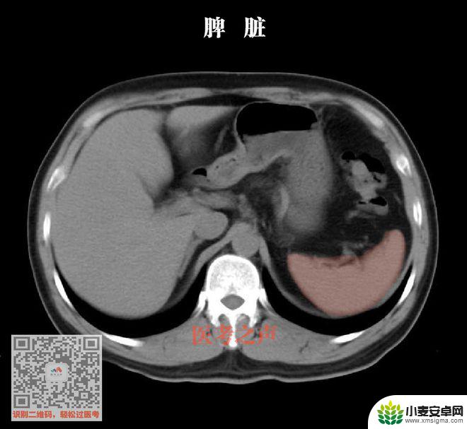 手机教你一招秒懂视频 CT阅片速成方法